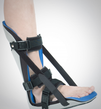 Orth&egrave;se tibio-p&eacute;dieuse de nuit et de jour, pr&eacute;fabriqu&eacute;es ou moul&eacute;es