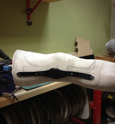 Orth&egrave;ses des membres inf&eacute;rieurs