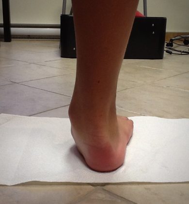 Analyse biom&eacute;canique